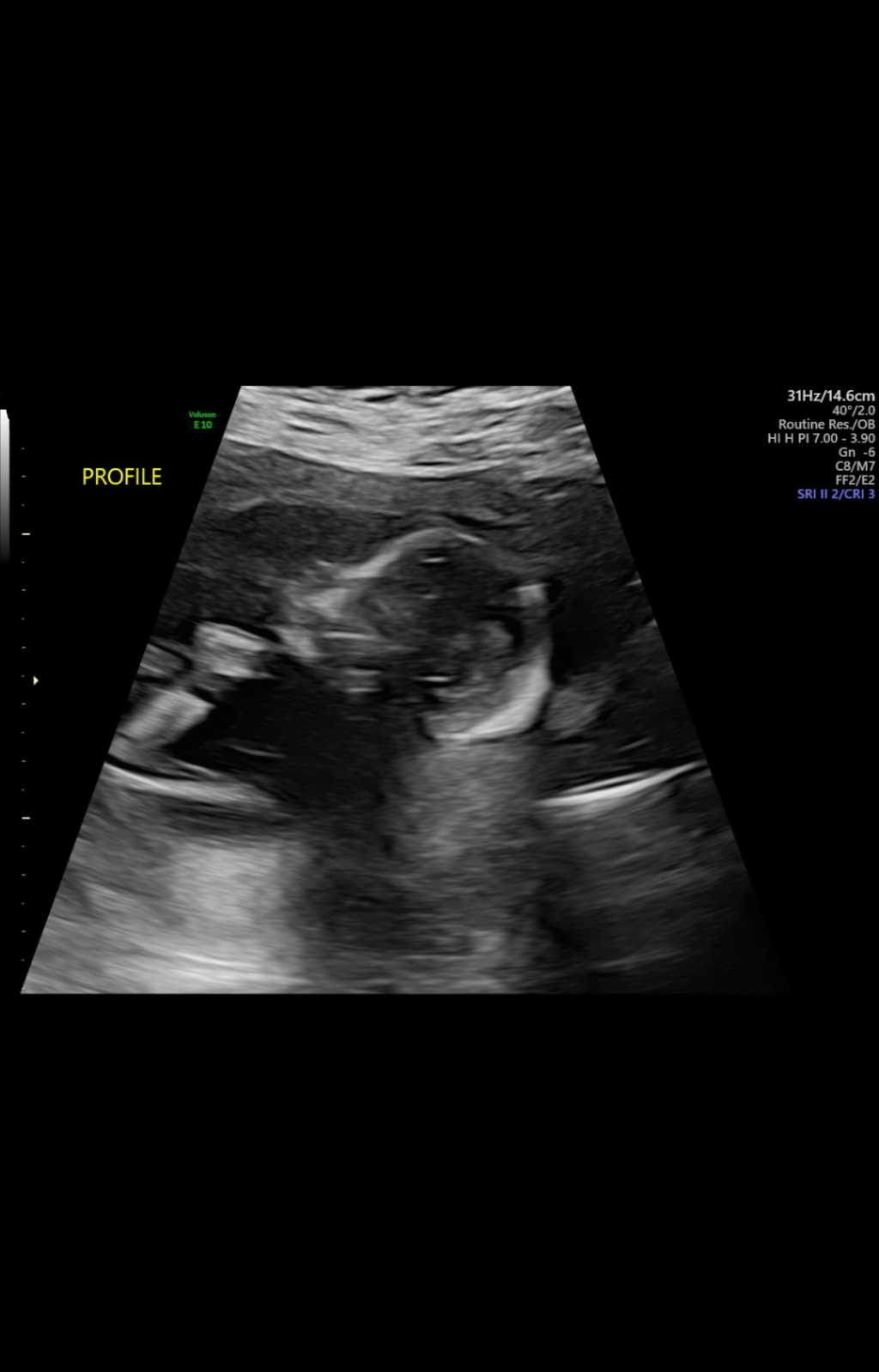 Why I’m Starting this Blog: A Second Chapter of&nbsp;Motherhood